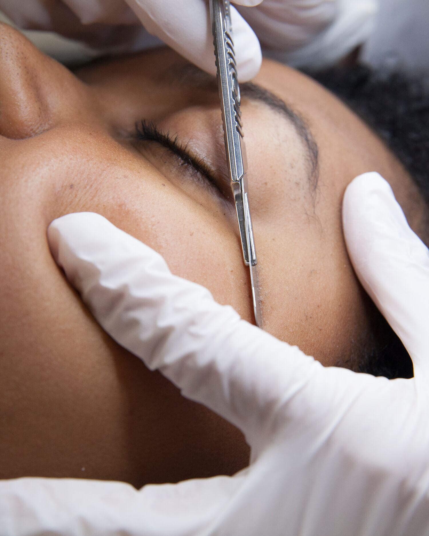 Dermaplane-Treatment_1500x1875